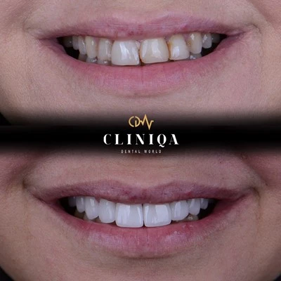 Cliniqa Dental World is a Professional Dental Clinic in Istanbul, Turkey.