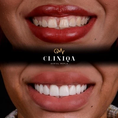Cliniqa Dental World is a Professional Dental Clinic in Istanbul, Turkey.