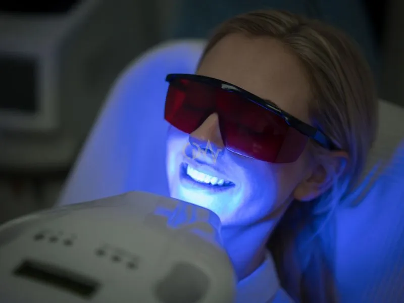 Teeth Whitening